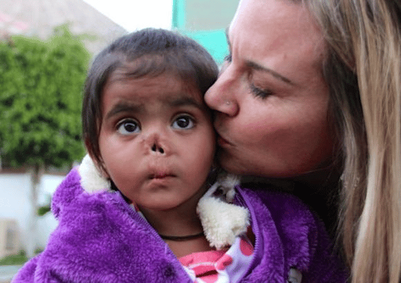 Тя осинови сираче без нос, намерено на бунището – вижте жената, която промени живота на 5 бездомни деца (Снимки)!