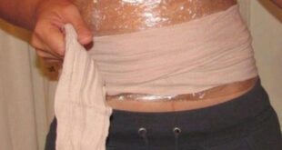 Вечерта сложих компреса, а на сутринта не можах да повярвам на очите си!