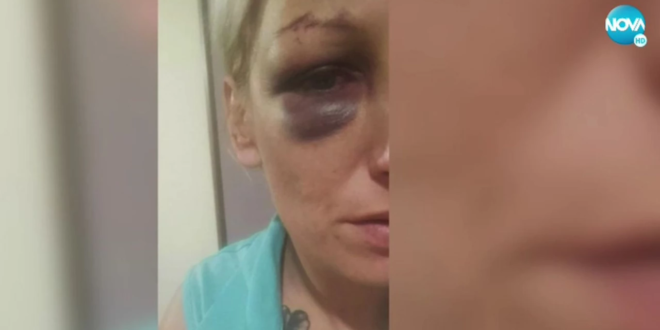 Ужас: Млада жена твърди, че е бита и държана в плен от бившия си мъж по време на новогодишните празници. Дори я заплашил, че ще й отреже главата с макетен нож