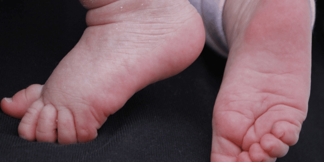 Четиризнаци се родиха в Алепо след земетресението